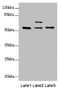ERO1A Antibody (PACO44633)