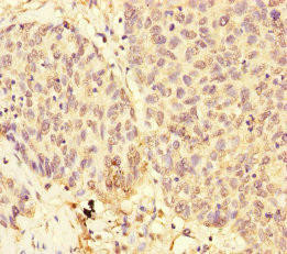 USP28 Antibody (PACO45632)
