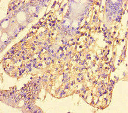 SRGAP2C Antibody (PACO46426)