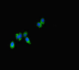 SPNS2 Antibody (PACO46794)