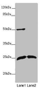 ARHGDIG Antibody (PACO47014)