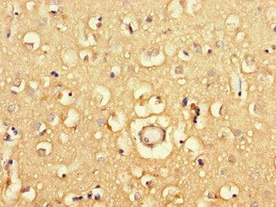 PGAP2 Antibody (PACO48142)