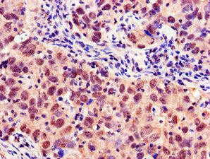 MYBL2 Antibody (PACO48410)