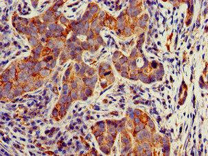TECPR2 Antibody (PACO49058)
