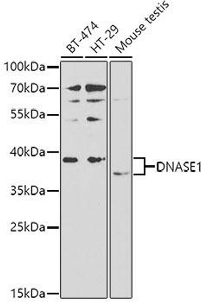 Anti-DNASE1 Antibody (CAB2537)