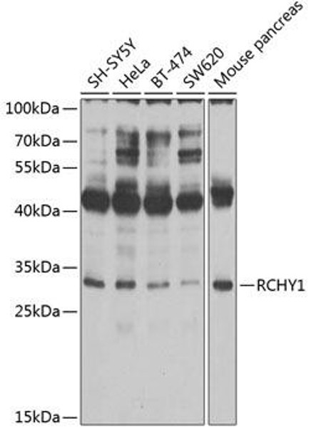 Anti-RCHY1 Antibody (CAB2789)