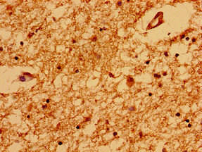 TRNP1 Antibody (PACO50702)