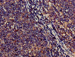 SAMD8 Antibody (PACO50794)