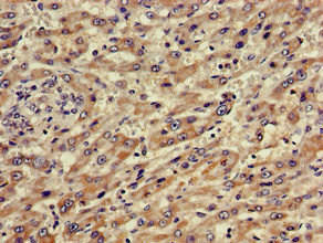 ABCA5 Antibody (PACO50862)