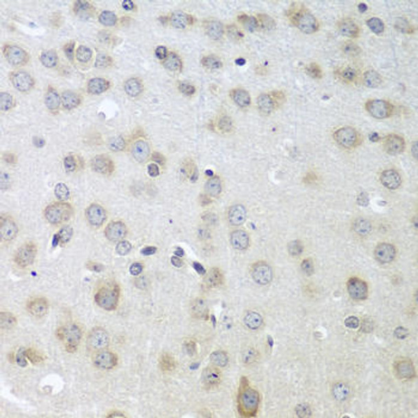 Anti-ACHE Antibody (CAB2806)