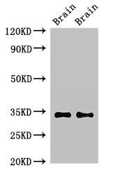 NPY6R Antibody (PACO50942)