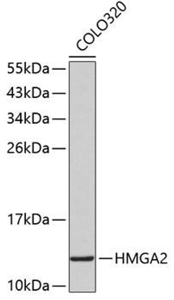 Anti-HMGA2 Antibody (CAB2972)