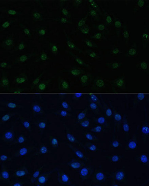 Anti-PELP1 Antibody (CAB3189)