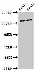 MAST3 Antibody (PACO54870)