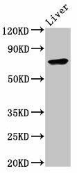 TNFAIP2 Antibody (PACO55806)
