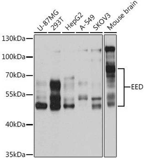 Anti-EED Antibody (CAB5371)
