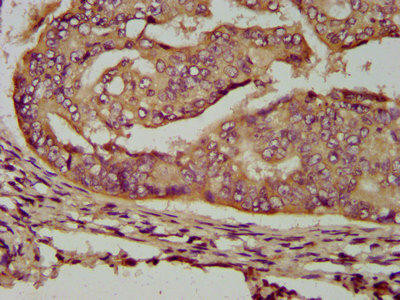 ENOSF1 Antibody (PACO58204)