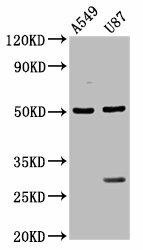 LANCL2 Antibody (PACO58476)