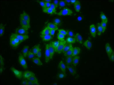 SLC5A4 Antibody (PACO59968)