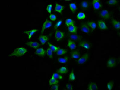 DPY19L2 Antibody (PACO60164)