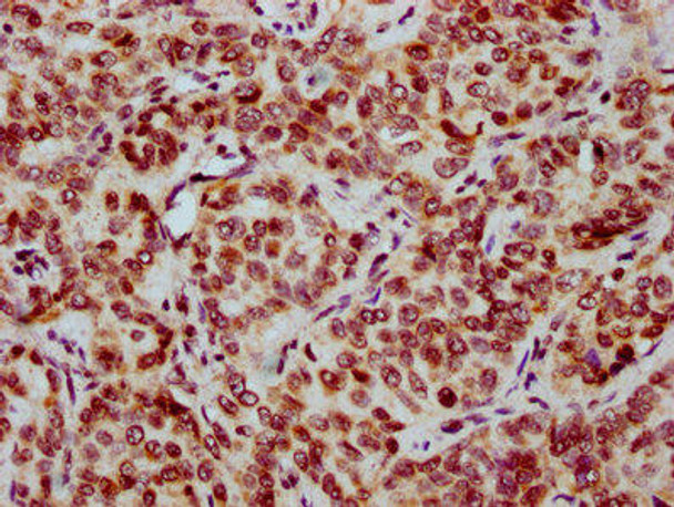 HIST1H2BC (Ab-12) Antibody (PACO60635)