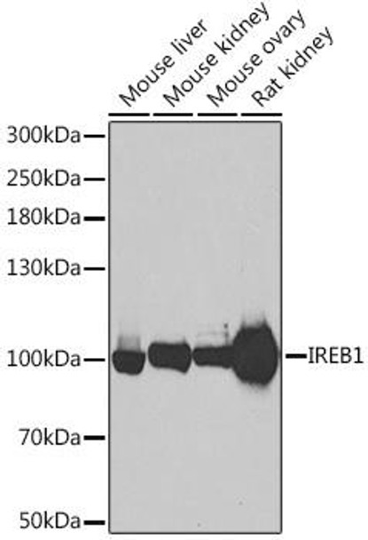 Anti-IREB1 Antibody (CAB6008)