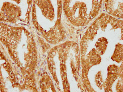 DYNC1LI1 Antibody (PACO62651)