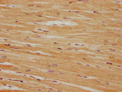 PPM1L Antibody (PACO63111)