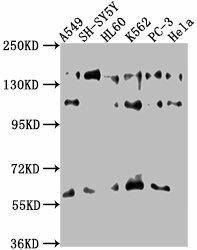 SOS2 Antibody (PACO63399)