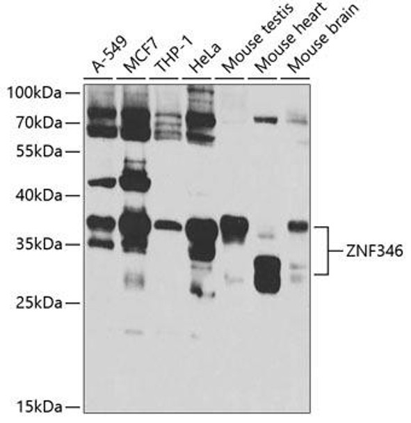 Anti-ZNF346 Antibody (CAB7507)