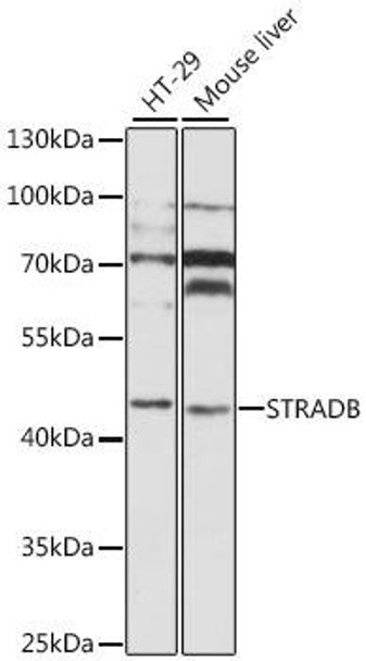 Anti-STRADB Antibody (CAB8651)