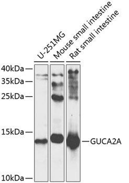 Anti-Guanylin Antibody (CAB9820)