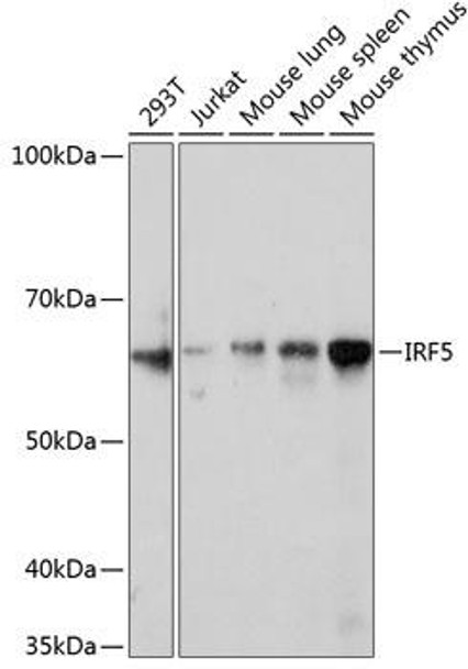 Anti-IRF5 Antibody (CAB11106)