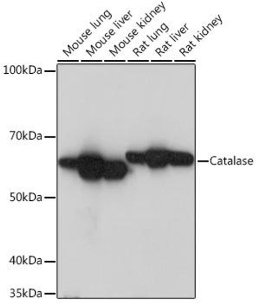 Anti-Catalase Antibody (CAB11220)