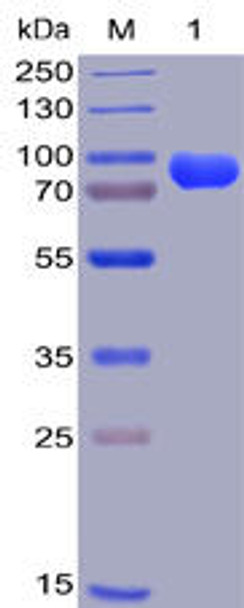 Human CD38 Recombinant Protein (hFc-His Tag) (HDPT0004)