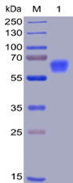 Human CD47 Recombinant Protein (mFc-His Tag) (HDPT0008)