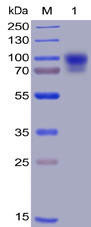 Human SIRPÎ± Recombinant Protein (hFc-His Tag) (HDPT0009)