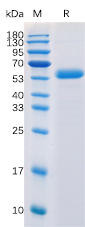Human CTLA-4 Recombinant Protein (mFc-His Tag) (HDPT0017)