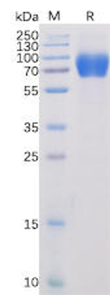 Human SLAMF1 Recombinant Protein (mFc-His Tag) (HDPT0024)