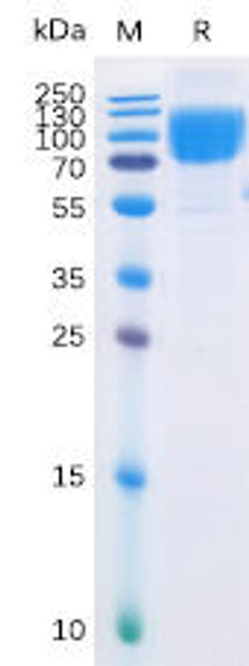 Human B7-2 Recombinant Protein (mFc-His Tag) (HDPT0034)