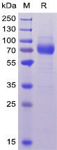 Human CD33 Recombinant Protein (hFc-His Tag) (HDPT0037)