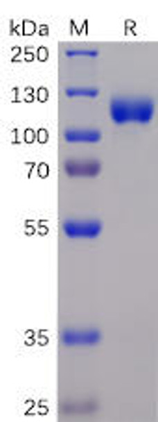 Human EPHA3 Recombinant Protein (mFc-His Tag) (HDPT0042)