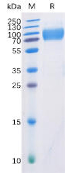 Human DNAM-1 Recombinant Protein (mFc-His Tag) (HDPT0044)