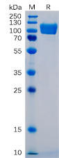 Human ICAM-1 Recombinant Protein (mFc Tag) (HDPT0049)
