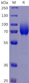 Human CSF1R Recombinant Protein (His Tag) (HDPT0052)