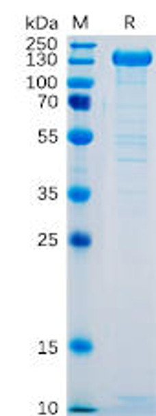 Human SELP Recombinant Protein (hFc Tag) (HDPT0066)