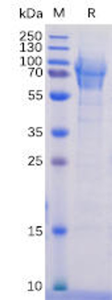 Human CD162 Recombinant Protein (His Tag) (HDPT0084)