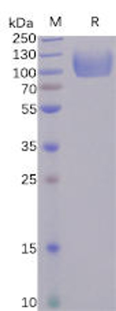 Human CD155 Recombinant Protein (hFc Tag) (HDPT0095)