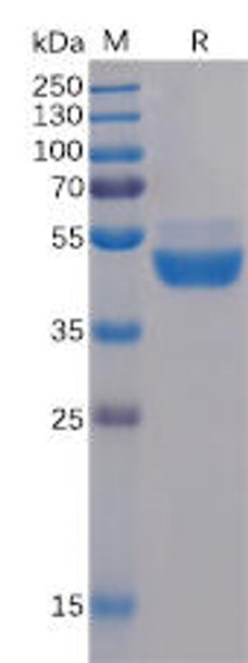 Human TIGIT Recombinant Protein (mFc Tag) (HDPT0109)