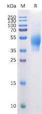 Human CD44 Recombinant Protein (His Tag) (HDPT0133)